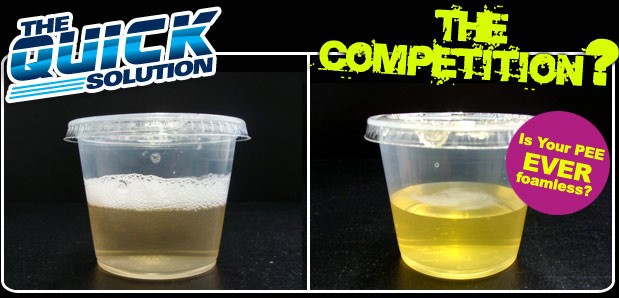 Synthetic 
      Urine With Temperature Union ME 4862